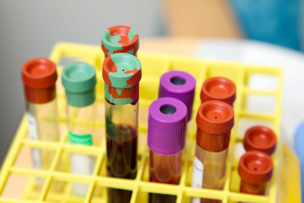 What Common Blood Tests Reveal